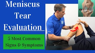 Meniscus Tear Evaluation 5 Most Common Signs and Symptoms [upl. by Drake]