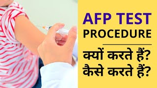 AFP Test for Liver Cancer in Hindi  AFP Test क्या होता हैं कैसे होता हैं [upl. by Leviralc829]