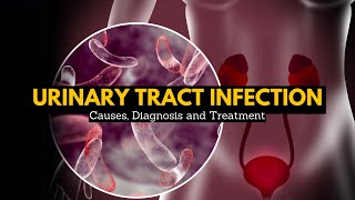 Urinary Tract Infection Causes Signs and Symptoms Diagnosis and Treatment [upl. by Mandler]