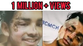 SteeveJosephAfter Accident Heart touching Video❤️ steevejoseph accident malluboy viral [upl. by Nesahc]