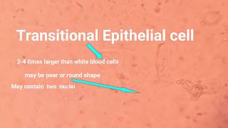 Epithelial cell types and its identification [upl. by Lemak]