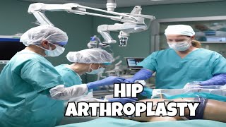 How Hip Arthroplasty Works Total Hip Replacement [upl. by Sulienroc842]