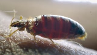 Insecticide resistant Bed bugs  The Ladykillers Pest Detectives  Episode 1 Preview  BBC Two [upl. by Joletta]