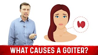 What Causes a Goiter Causes of Thyroid Enlargement – DrBerg [upl. by Houlberg342]