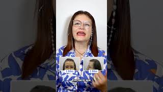 Trasplante Capilar en Mujeres 😱 Recupera tu cabello con los mejores Agenda tu valoración gratuita ✨ [upl. by Sanson]