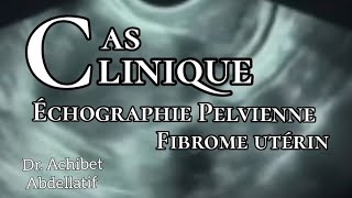 Dr Achibet  formation  Échographie pelvienne  fibrome utérin [upl. by Ardnovahs]