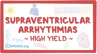 Supraventricular arrhythmias Pathology review [upl. by Eelinej]