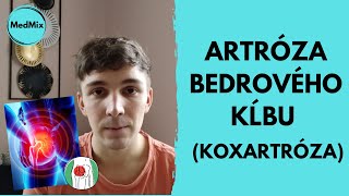 ARTRÓZA BEDROVÉHO KĹBU KOXARTRÓZA [upl. by Genie]