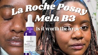 La Roche Posay Mela B3 Serum Faded Dark Spots amp Glowing Skin  HONEST Review [upl. by Guerra89]