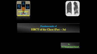 HRCT chest for Radiology Residents  Part 3a  Reticular Pattern [upl. by Petersen]