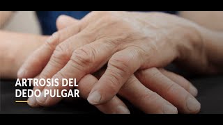 Rizartrosis Artrosis del pulgar 👍 Terapia en casa [upl. by Uol]