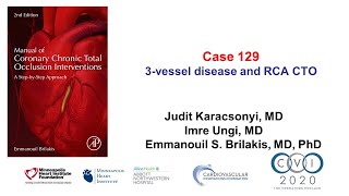 Case 129 Manual of CTO Interventions  3 vessel disease  RCA CTO [upl. by Airekahs]