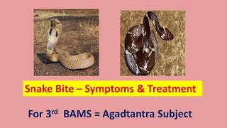 Snake Bite Treatment l Symptoms l Poisonous amp Non poisonous snakes l Snake Antivenom injection [upl. by Einreb]