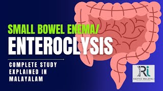 Small bowel enema  complete study തപ്പി ഇനി എങ്ങും പോകണ്ട എളുപ്പത്തിൽ മനസിലാക്കാം [upl. by Arihaj]