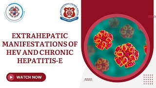 Extrahepatic manifestations of HEV and Chronic Hepatitis E [upl. by Jochbed]