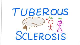 Tuberous Sclerosis Complex TSC [upl. by Yardna]