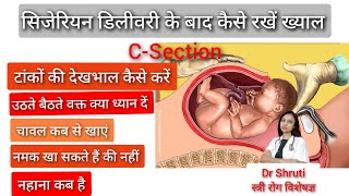 सिजेरियन डिलीवरी के बाद अपना ख्याल कैसे रखें। CSection । Care after Cesarean deliveryDr Shruti [upl. by Nhor]