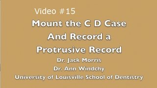 Video 15 C D Mount the Case amp Record a Protrusive Record [upl. by Hachmann]