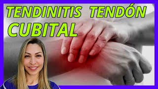 👍🏼TENDINITIS CUBITAL de MUÑECADolor muñeca en la parte externaTRATAMIENTO fisioterapia [upl. by Lanta]