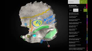 petrous part of temporal bone 1 [upl. by Ordnaxela371]
