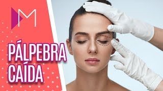 Blefaroplastia saiba tudo sobre cirurgia nas pálpebras  Mulheres 170918 [upl. by Delacourt]