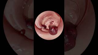 The ULTIMATE Guide to Gastrointestinal Endoscopy  Step by Step Tutorial [upl. by Notrom993]