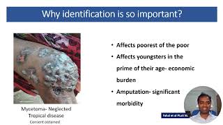 Importance of speciation in medical mycology  Dr Vinaykumar Halluru  MycoAsia [upl. by Picco]