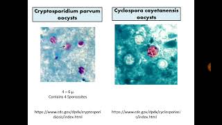 Para Findings 7 Cryptosporidium Cyclospora and Cystisospora in Stool with MZN stain [upl. by Lally162]