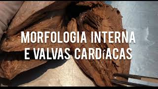 Anatomia do coração parte 2 morfologia interna e valvas cardíacas [upl. by Notserp]