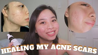 HOW I HEAL MY ACNE SCARS  I switched to BCP TRETINOIN 05  9 weeks update ♡ [upl. by Vere334]