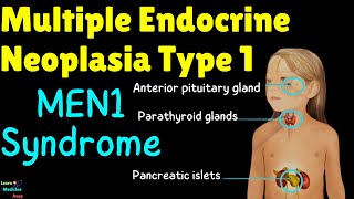 Multiple Endocrine Neoplasia Type 1 MEN1 Syndrome – Causes Symptoms Treatment Pathology [upl. by Orravan259]