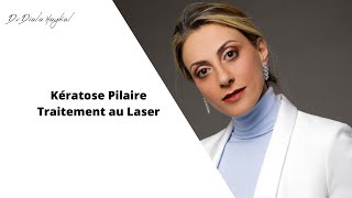 🔴Kératose pilaire Traitement au Laser [upl. by Trev]