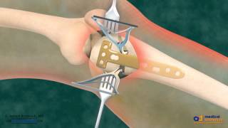 Knee joint structure and actions [upl. by Siegel]