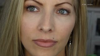 Restylane Filler Injections for Under Eye Puffiness  4 mo Follow Up [upl. by French]