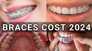 Braces Type amp Treatment Cost 2024  Metal vs Ceramic vs Lingual vs Invisalign Braces  Latest [upl. by Yahsram830]