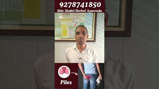 Piles Treatment Success Patient Testimonial Video [upl. by Iadahs948]