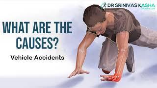 Broken wrist is generally a result of falling on to an outstretched hand  Dr Srinivas Kasha [upl. by Beera]