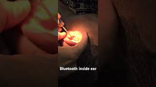 Bluetooth inside ear Dr Hitesh Patel [upl. by Bald114]