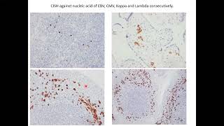 Histopathological techniques Molecular pathology 2 [upl. by Shuman599]