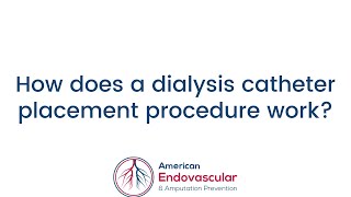 How does a dialysis catheter placement procedure work [upl. by Winfield]