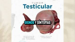 Tumor testicular [upl. by Eramal]