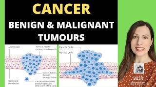 CANCER Alevel Biology Benign and malignant tumours and how tumours develop [upl. by Belia]