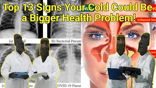 Top 13 Signs Your Cold Could Be a Bigger Health Problem [upl. by Limbert]