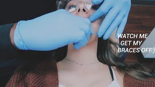 GETTING BRACES OFF 2019 [upl. by Yance]