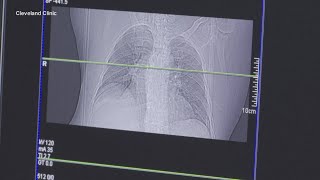 US Surgeon General issues new warning about lung cancer [upl. by Azriel77]