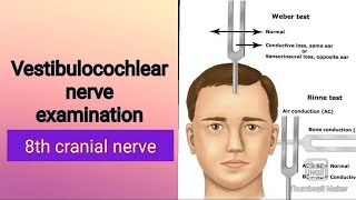 8th cranial nerve examination Physiology [upl. by Htebiram18]