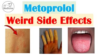 Metoprolol amp Beta Blockers Weird Side Effects Skin Gastrointestinal Psychological [upl. by Aixela843]