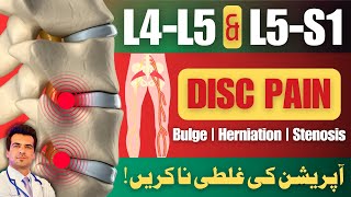 L4L5 amp L5S1 Disc Bulge Treatment  No Surgery  Home Treatment  UrduHindi [upl. by Noyes]