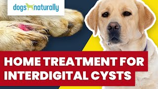 Home Treatment For Interdigital Cysts [upl. by Ezirtaeb]