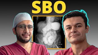 Ep 16 Mastering Bowel Obstruction Management Essential Tips for Surgeons [upl. by Reeher]